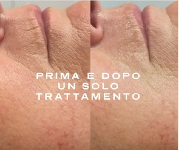 collagene viso